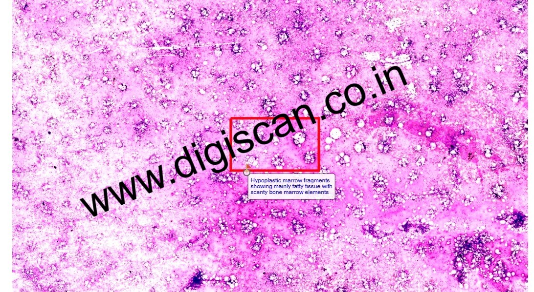 Hematology Digital Slides Set (Peripheral Blood Smear & Bone Marrow Slides)